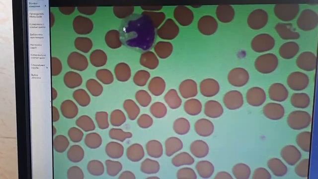 Подсчёт лейкоцитарной формулы с нуля смотреть онлайн