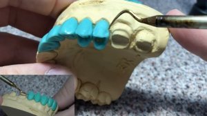 Как моделировать зубы? Моделировка премоляра верхней челюсти. Зубной техник. Изготовление зубов.