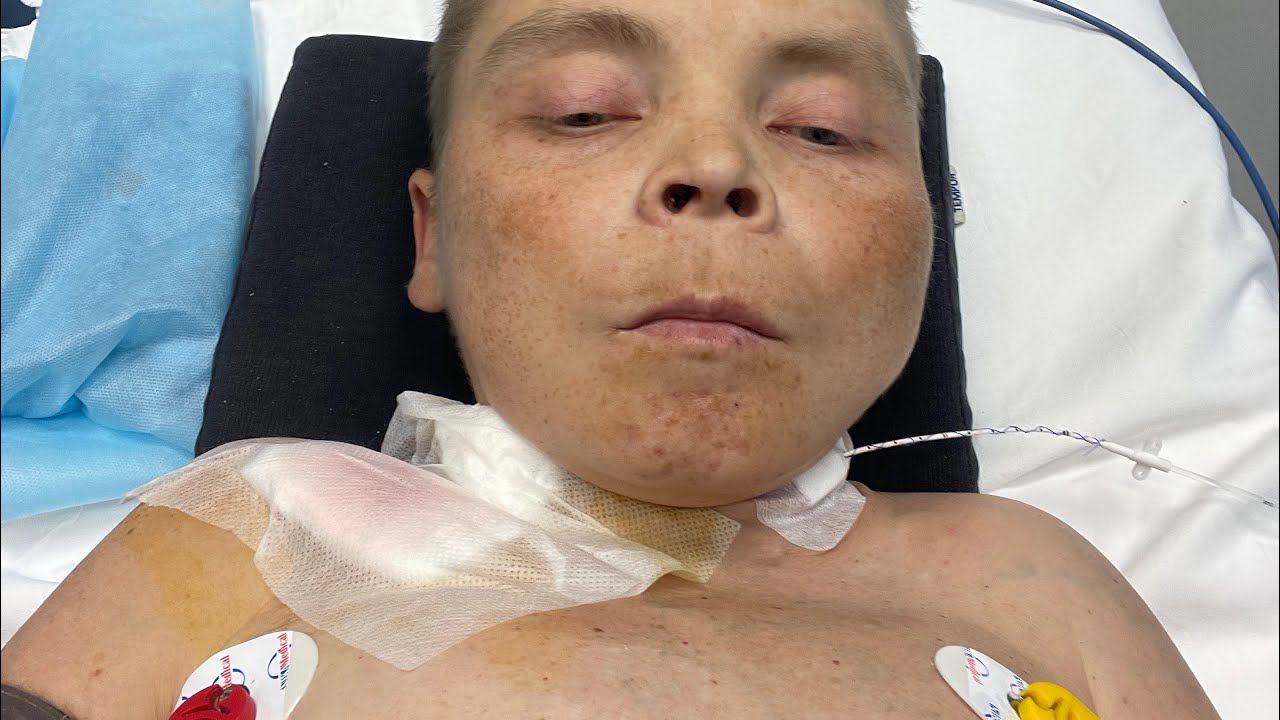 Мне сделали операцию установили перманент как все прошло? смотреть онлайн