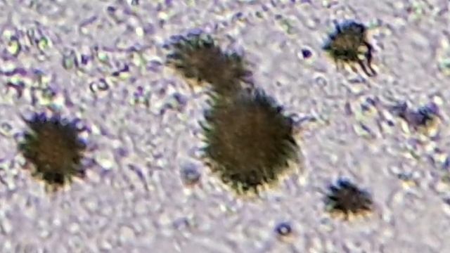 тест-полоска для мочи смотреть онлайн