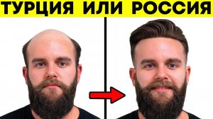 Почему все летят на пересадку волос в Турцию? Где лучше пересаживать волосы: в Турции или в России?