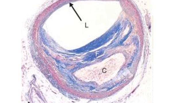 CARDIOVASCULAR 1