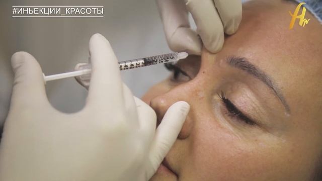 Ботулинотерапия смотреть онлайн