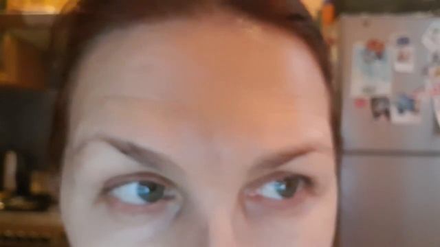 Где я пропала?  Почему молчала? Шишка на лбу/provenceallochka Vlog