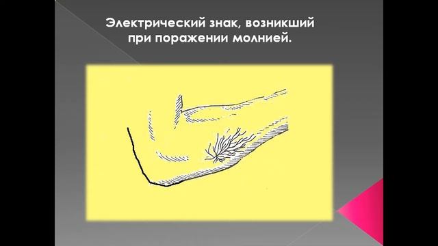 Электрические травмы и их последствия