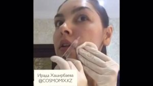 Мезотерапия самой себе!