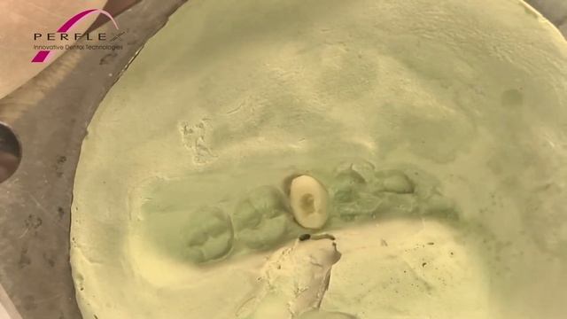 Perflex Flexinylon - adding a new tooth/clasp instructions смотреть онлайн