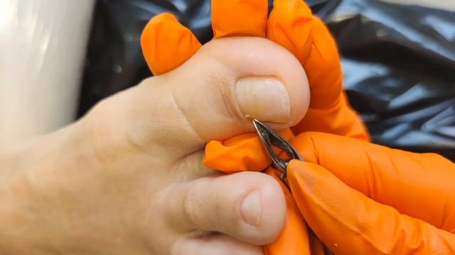 Педикюр с присыпкой??? смотреть онлайн