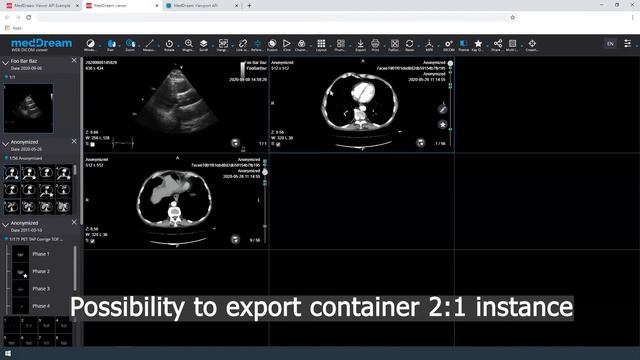 MedDream DICOM Viewer: API integration examples смотреть онлайн
