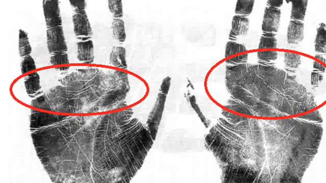 Хиромантия / ВИЧ положительный / знаки на ладони смотреть онлайн