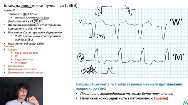 Внутрішньошлуночкові блокади. ЕКГ діагностика смотреть онлайн