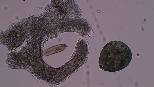 Amoeba hunts and kills paramecia and stentor... to music by Lamar; Genesis; Winter; Zimmer смотреть онлайн