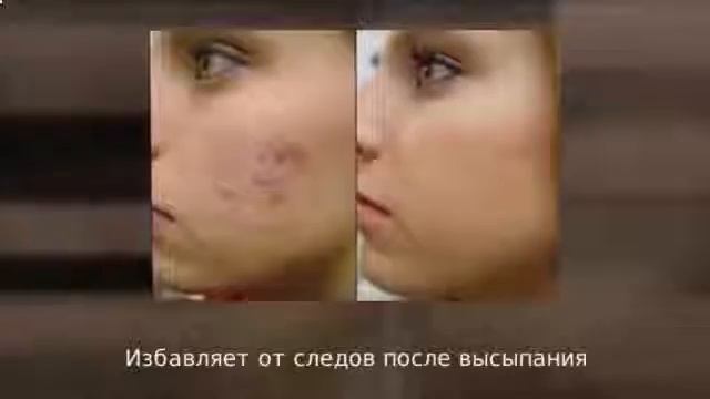 Милк Скин крем от пигментных пятен