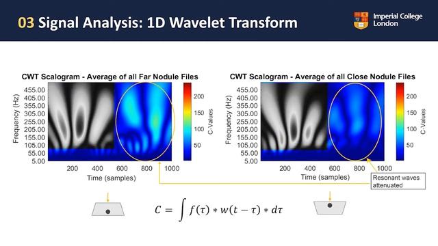 Acoustic Response Analysis of Medical Percussion using Wavelet Transform and Neural Networks смотреть онлайн