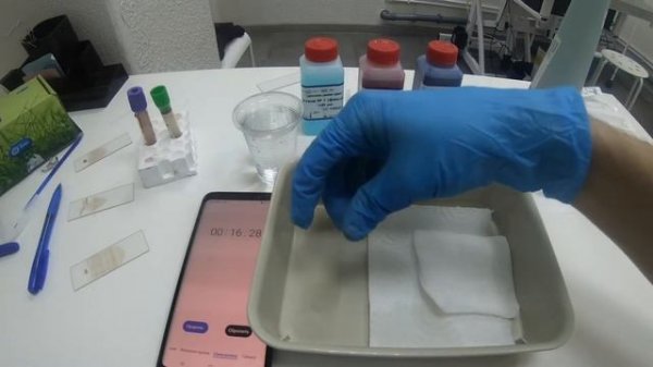 окраска мазков методом дифф - квик ( Diff - quick )