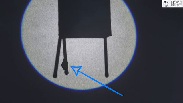 Как правильно делать прицельные снимки / How to Dentist смотреть онлайн