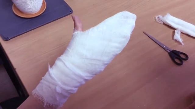 Оказание первой помощи при ожогах