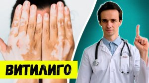 Витилиго: белые пятна на коже. Что это и как лечить ♂️