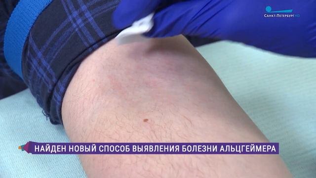 Петербургские ученые нашли способ выявлять болезнь Альцгеймера до первых симптомов смотреть онлайн