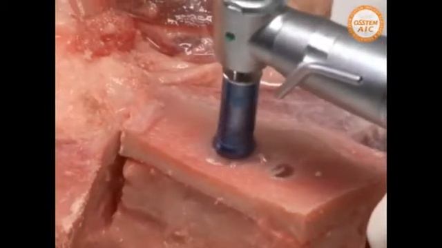 CAS KIT Pig Jaw nerve смотреть онлайн