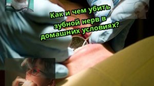 Как и чем убить зубной нерв в домашних условиях?