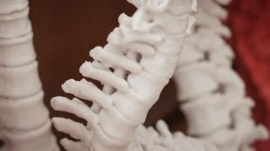 Российские хирурги внедрили уникальную методику коррекции сколиоза у взрослых