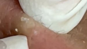 Enjoy Facial Treatment With Sac Dep Spa 2022 | 1119