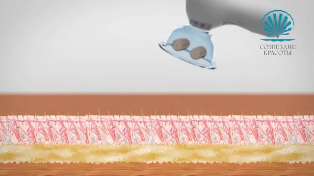 Вакуумный массажер Vacu Pro смотреть онлайн