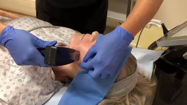 Morpheus8 Demonstration On Neck And Lower Face | San Diego | Aesthetic Arts Institute