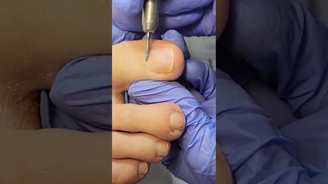 Аппаратный педикюр. Курсы педикюра. #shorts смотреть онлайн