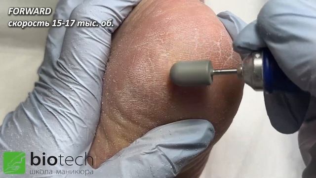 АППАРАТНЫЙ ПЕДИКЮР С КЕРАТОЛИТИКОМ. смотреть онлайн