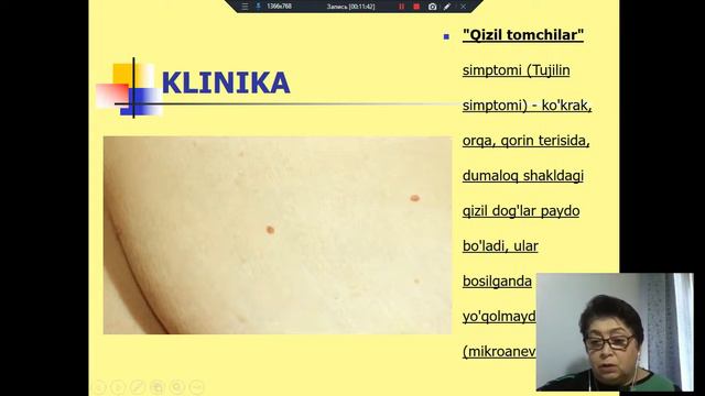 Sur pankreatit смотреть онлайн