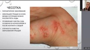 Виды сыпей у детей