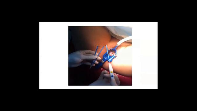 COLPOSCOPÍA. 4TA FECHA. Tema 16. (20191203) @emccmp6037 смотреть онлайн