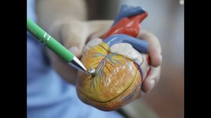 Малоинвазивное аорто-коронарное шунтирование