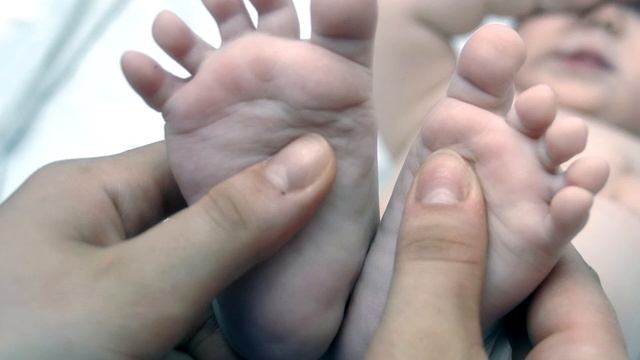 Почему слезают ногти у ребенка на руках? смотреть онлайн