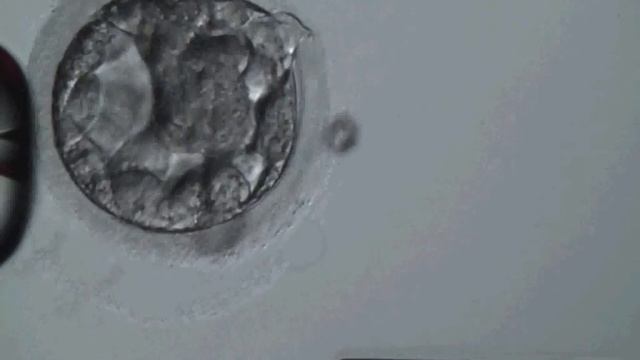 Биопсия эмбриона смотреть онлайн