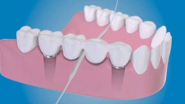SUPER FLOSS - ORAL B смотреть онлайн