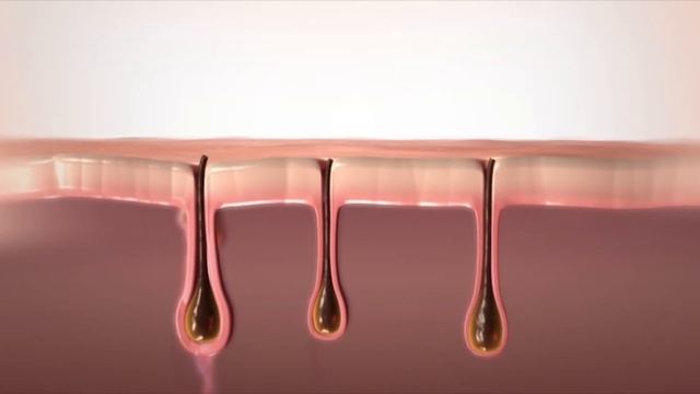 Фотоэпиляция Lumenis М22