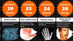 Сравнение: САМЫЕ СИЛЬНЫЕ ЧЕЛОВЕЧЕСКИЕ БОЛИ по шкале от 1 до 100