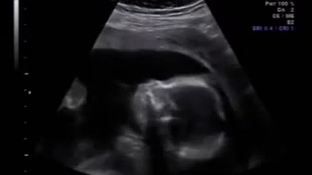 Alessia Eco Morfologica 24 02 2009