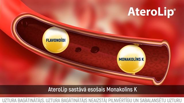 Paaugstināts holesterīns? смотреть онлайн