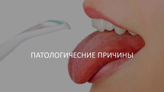 Белый налет на губах после сна: причины возникновения смотреть онлайн