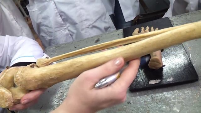 Кости нижних конечностей. Голень. Стопа. Бедро. Урок 4