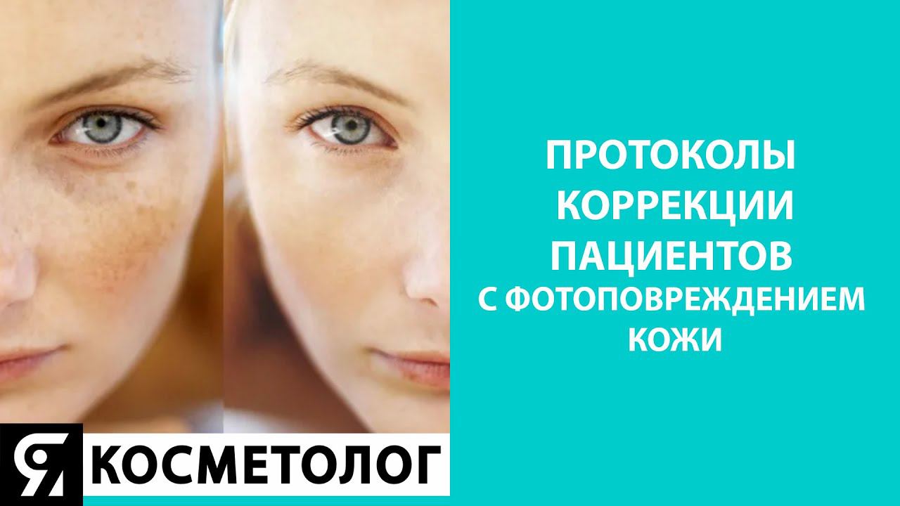 Протоколы коррекции пациентов с фотоповреждением кожи смотреть онлайн