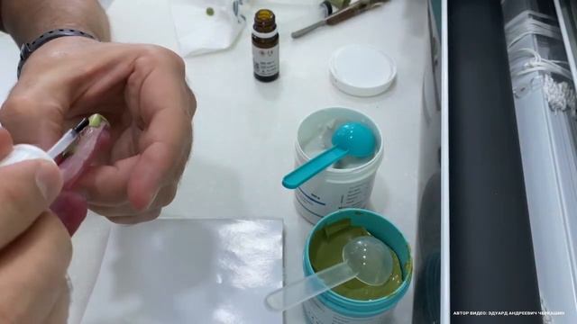 Оформление краев индивидуальной ложки для функционального оттиска при полном съемном протезировании смотреть онлайн