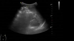 Ультразвуковая анатомия  органов брюшной полости и забрюшинного пространства