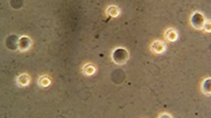 гемолиз эритроцитов