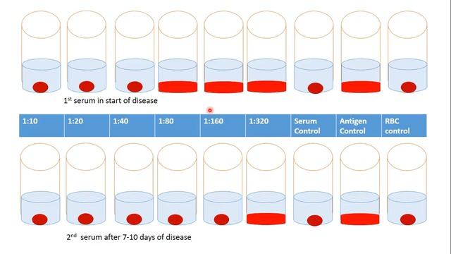 Reaction of inhibition of hemagglutination for detection the antibidies in pair sera смотреть онлайн