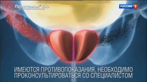 Простамол Уно